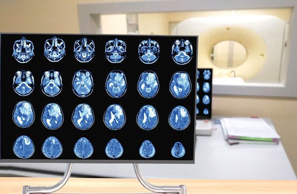 Wenn Krebszellen sich selbst vernichten