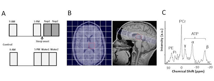 Tagesbedingte metabolische Veränderungen im menschlichen Gehirn