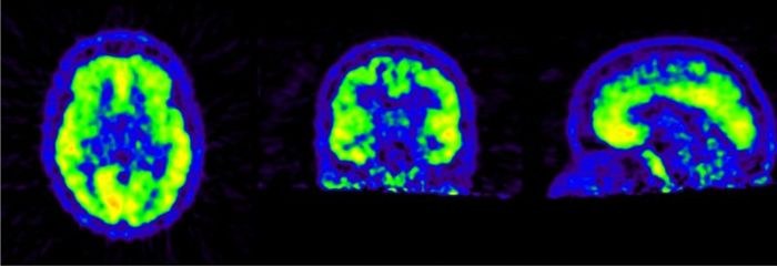 Gesunde Probanden gesucht