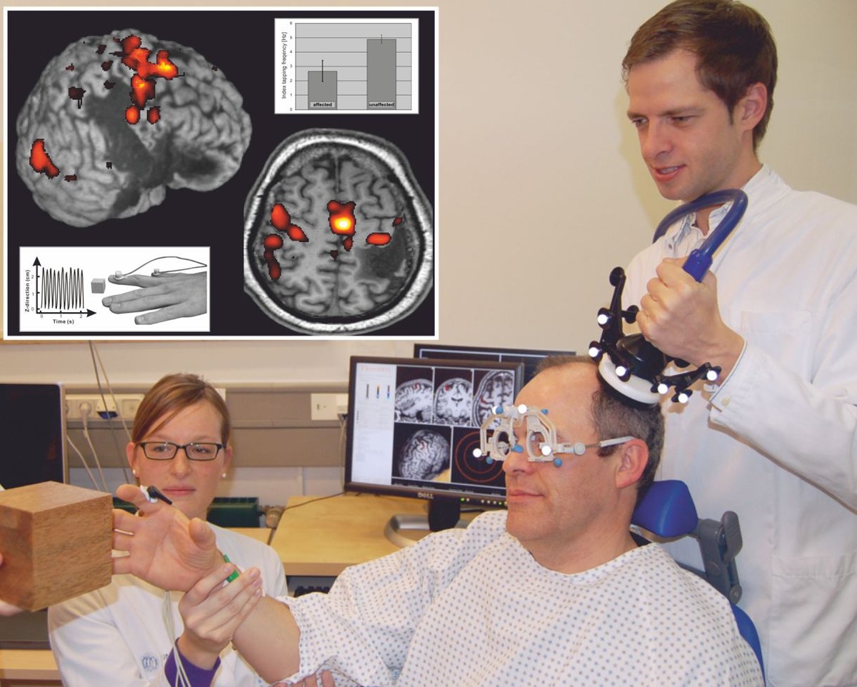 Rehabilitation of cognitive impairments