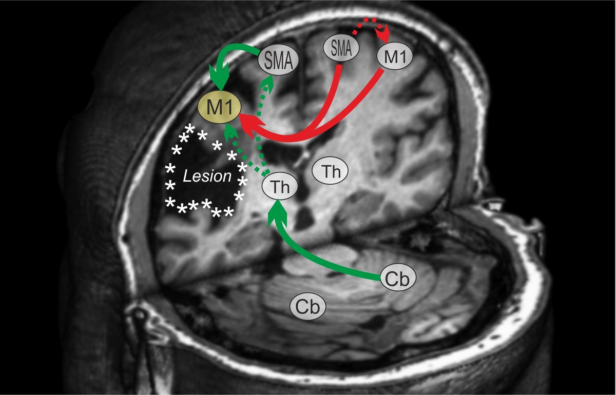 Rehabilitation of cognitive impairments
