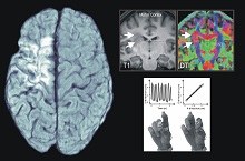 Rehabilitation of cognitive impairments