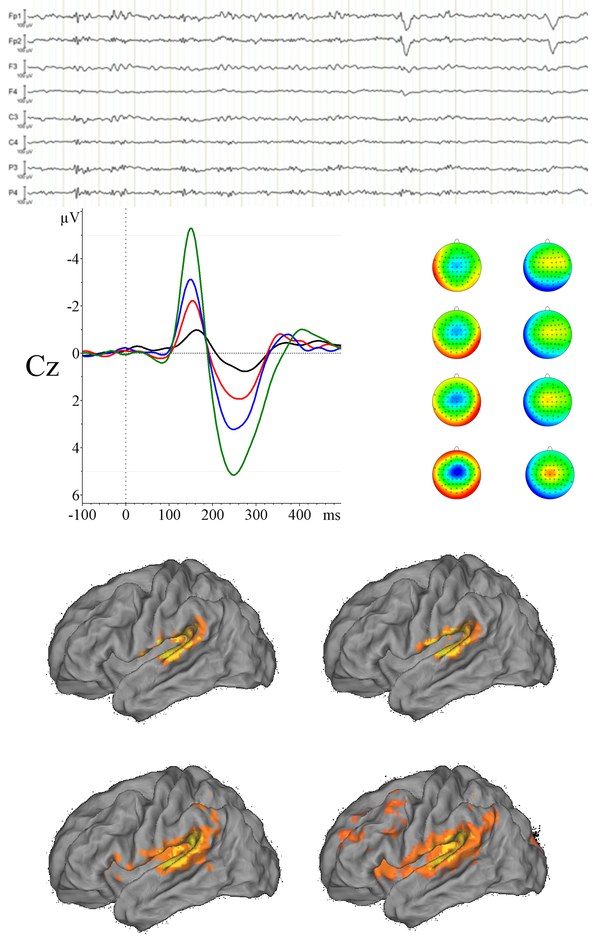 fMRI & EEG