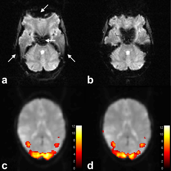 EPIK & High-resolution fMRI