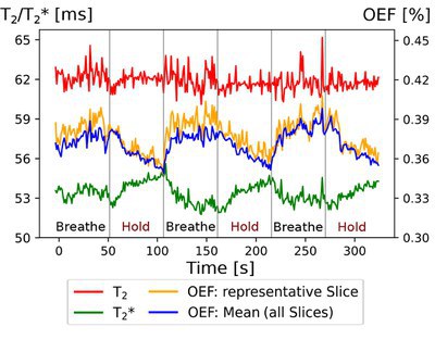 Development of a new method to measure oxygen extraction fraction