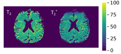 Development of a new method to measure oxygen extraction fraction