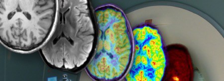 Imaging the human brain