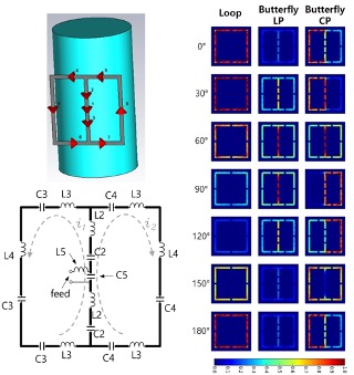 New Butterfly Coil Demonstrates Improved Signal Quality