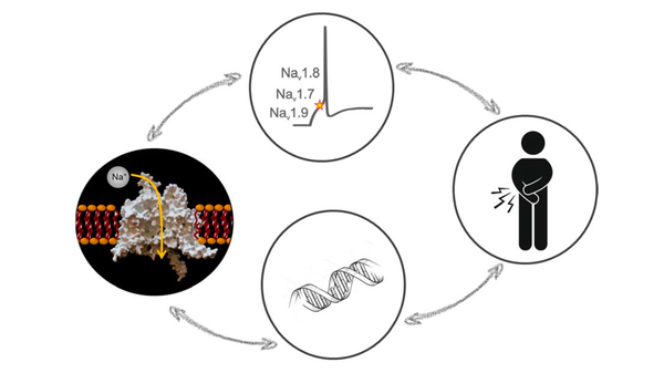 Pain and neuroinflammation